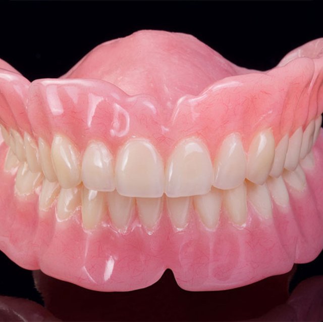 Removable Acrylic Dentures